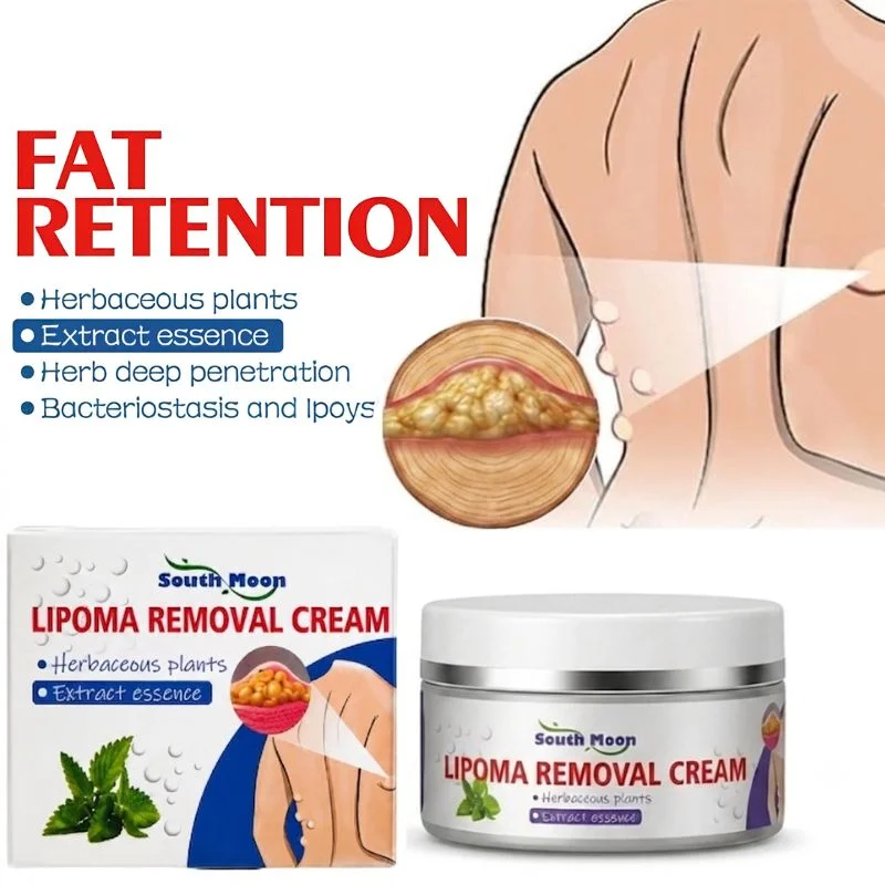 Lipoma Removal Cream | Herbal Skin Care Cream for Smooth & Nourished Skin | Fast-Absorbing Formula | For Neck & Body | 50g - Image 3